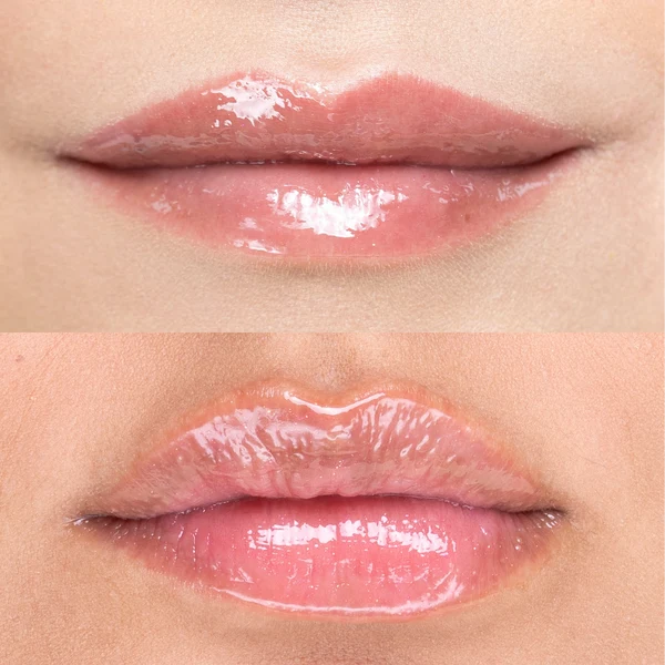 LIP OIL | ATENEA