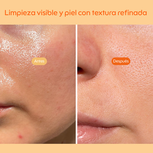 Refining Enzyme Cleanser - KIERÓ